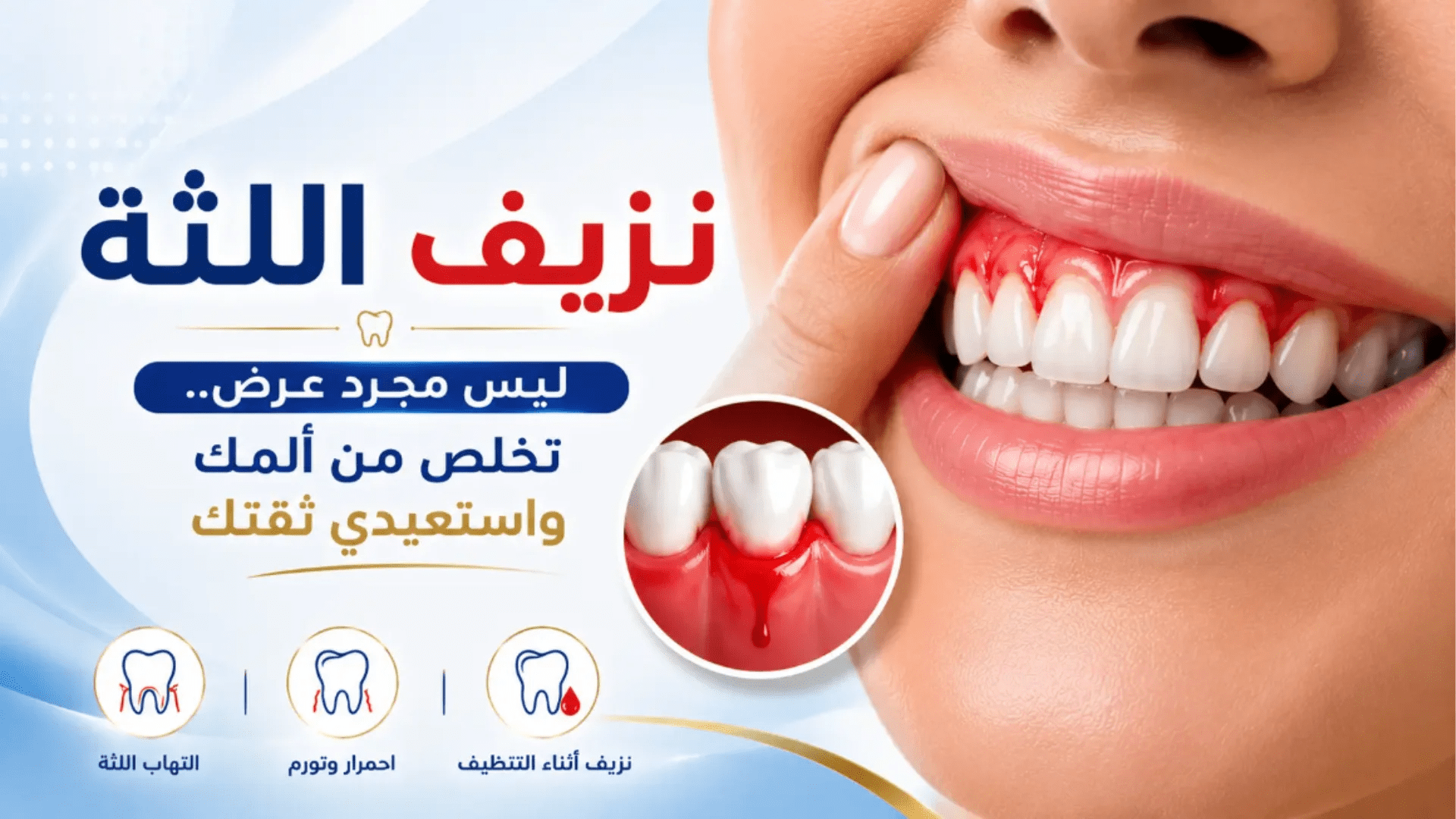أعراض نزيف اللثة والتهاب اللثة مع توضيح أسباب النزيف أثناء تنظيف الأسنان وطرق العلاج