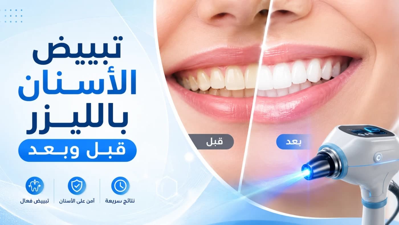 دليل تبيض الأسنان بالليزر