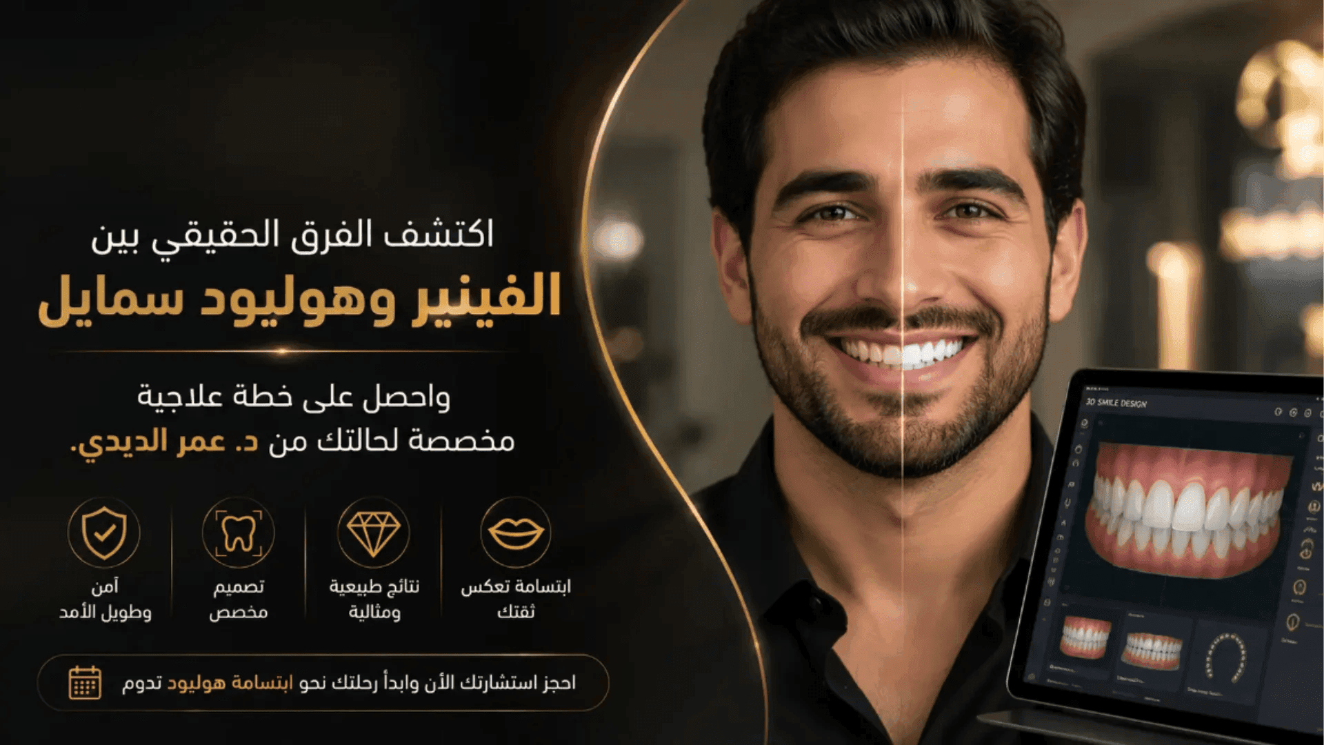 هوليود سمايل والفينير: وش تختار؟ د. عمر الديدي بالقاهرة يوضح لك الفرق
