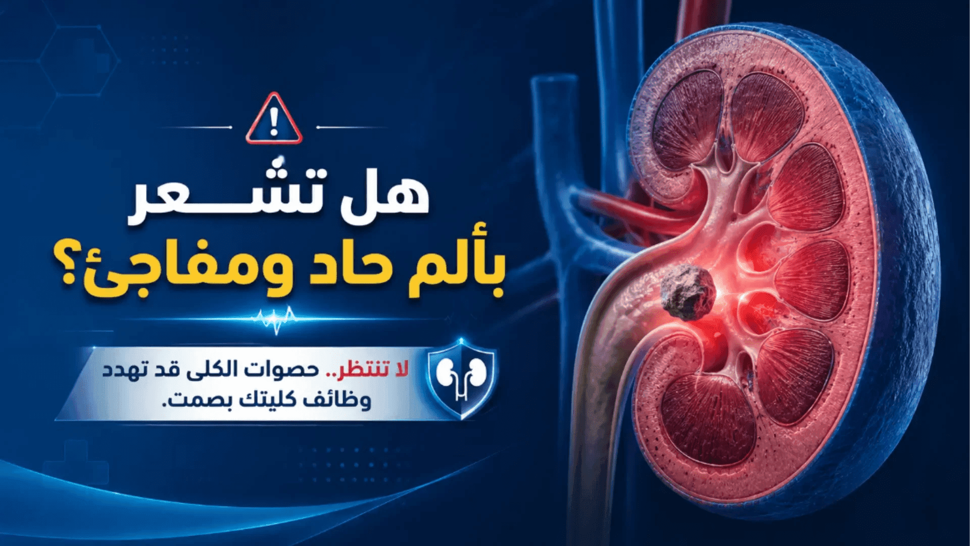 حصوات الكلى تسبب ألمًا حادًا ومفاجئًا وقد تؤثر على وظائف الكلى إذا لم تُعالج