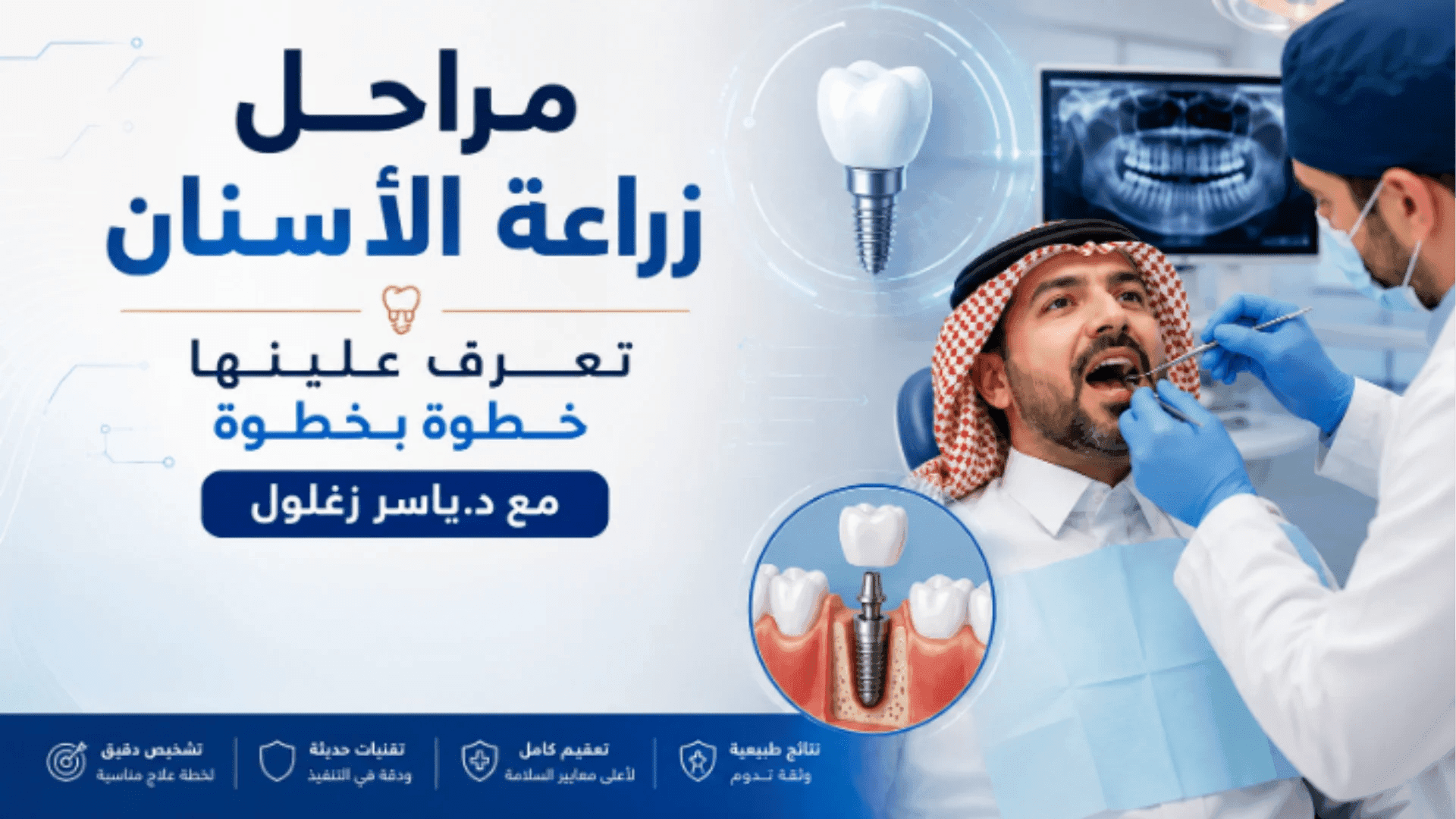 عيادة دكتور ياسر زغلول للأسنان بمصر، خيارك الأول لزراعة الأسنان وتجميلها ضمن رحلتك العلاجية مراحل زراعة الأسنان بالتفصيل