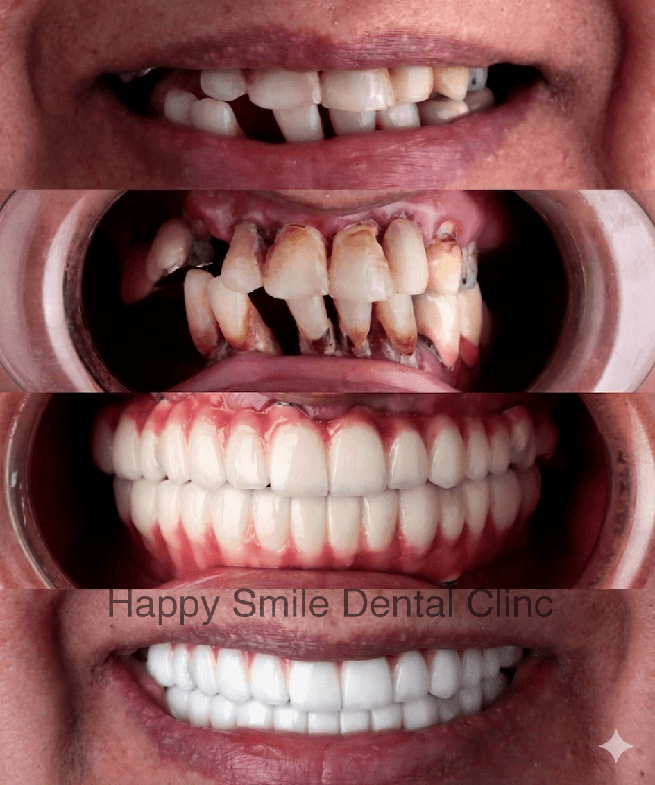 من اسنان متهالكه لابتسامه قويه ومشرقه اضحك من قلبك في هابي سمايل للتواصل 011 42778705