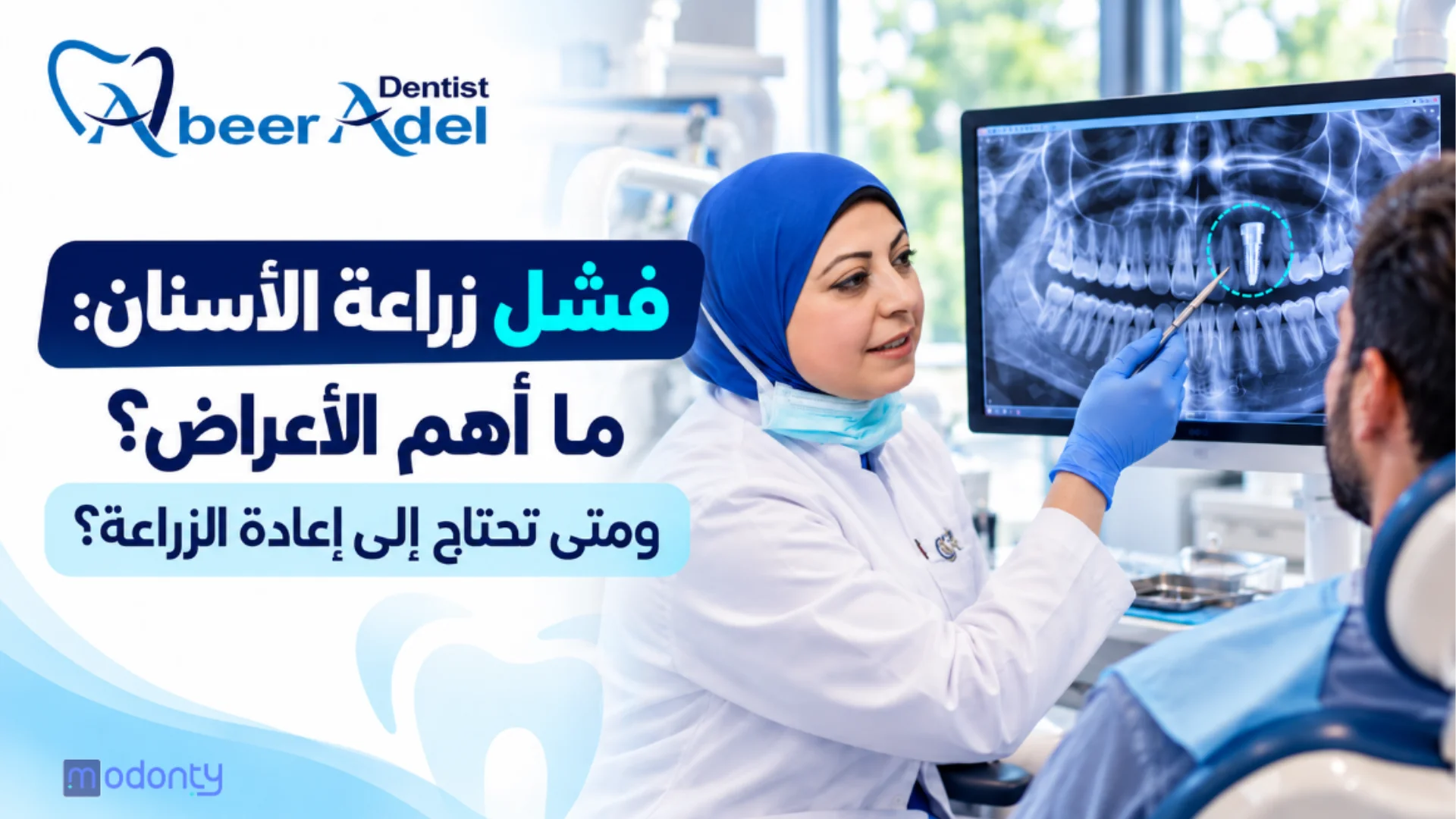 فشل زراعة الأسنان؟ تعرف على الأعراض والحلول مع عيادة د. عبير عادل بالقاهرة