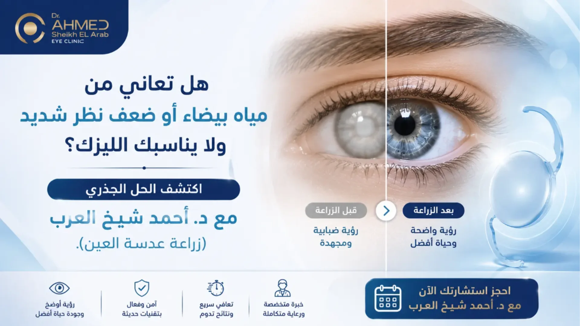 زراعة عدسة العين مع استشاري العيون د. أحمد شيخ العرب بالقاهرة