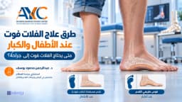 طرق علاج الفلات فوت عند الأطفال والكبار: متى يحتاج إلى جراحة؟
