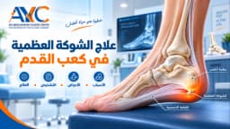 علاج الشوكة العظمية في كعب القدم: هل الشوكة هي سبب ألم الكعب؟