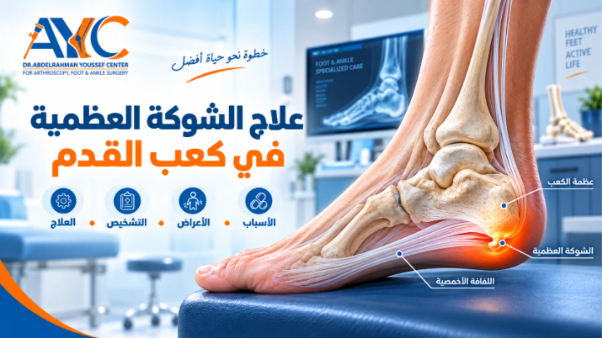 علاج الشوكة العظمية في كعب القدم في مصر دكتور عبد الرحمن يوسف