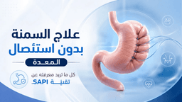 علاج السمنة بدون استئصال المعدة: الدليل الشامل لتقنية SAPI