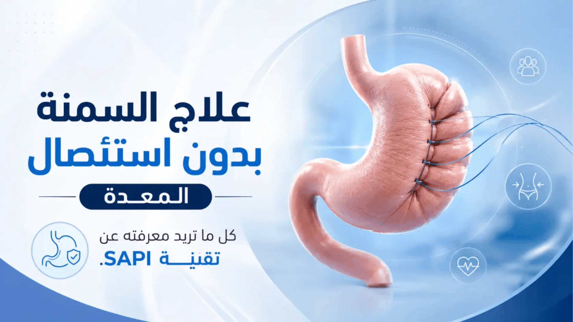 تقنية SAPI المبتكرة لعلاج السمنة وطي المعدة للمراهقين والأوزان المتوسطة.