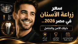 كم سعر زراعة الأسنان في مصر؟ دليلك الشامل لرحلة علاج ناجحة ومضمونة