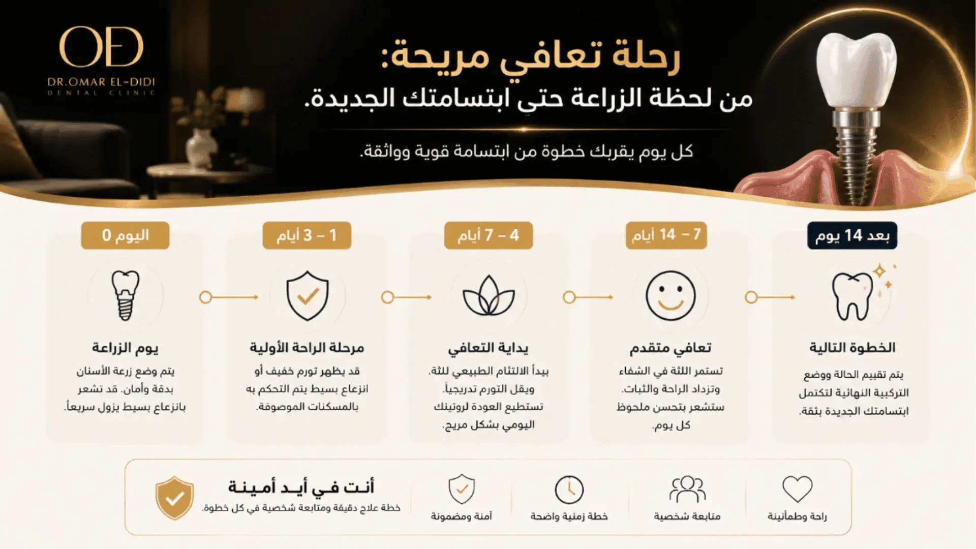 إنفوجرافيك يوضح مراحل التعافي بعد زراعة الأسنان من يوم الزراعة حتى اكتمال الشفاء