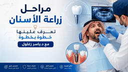 ما هي مراحل زراعة الأسنان بالتفصيل ؟ تعرف عليها خطوة بخطوة مع د. ياسر زغلول