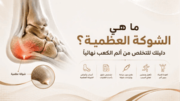 ما هى العظمة الشوكية؟ دليلك للتخلص من ألم الكعب نهائياً
