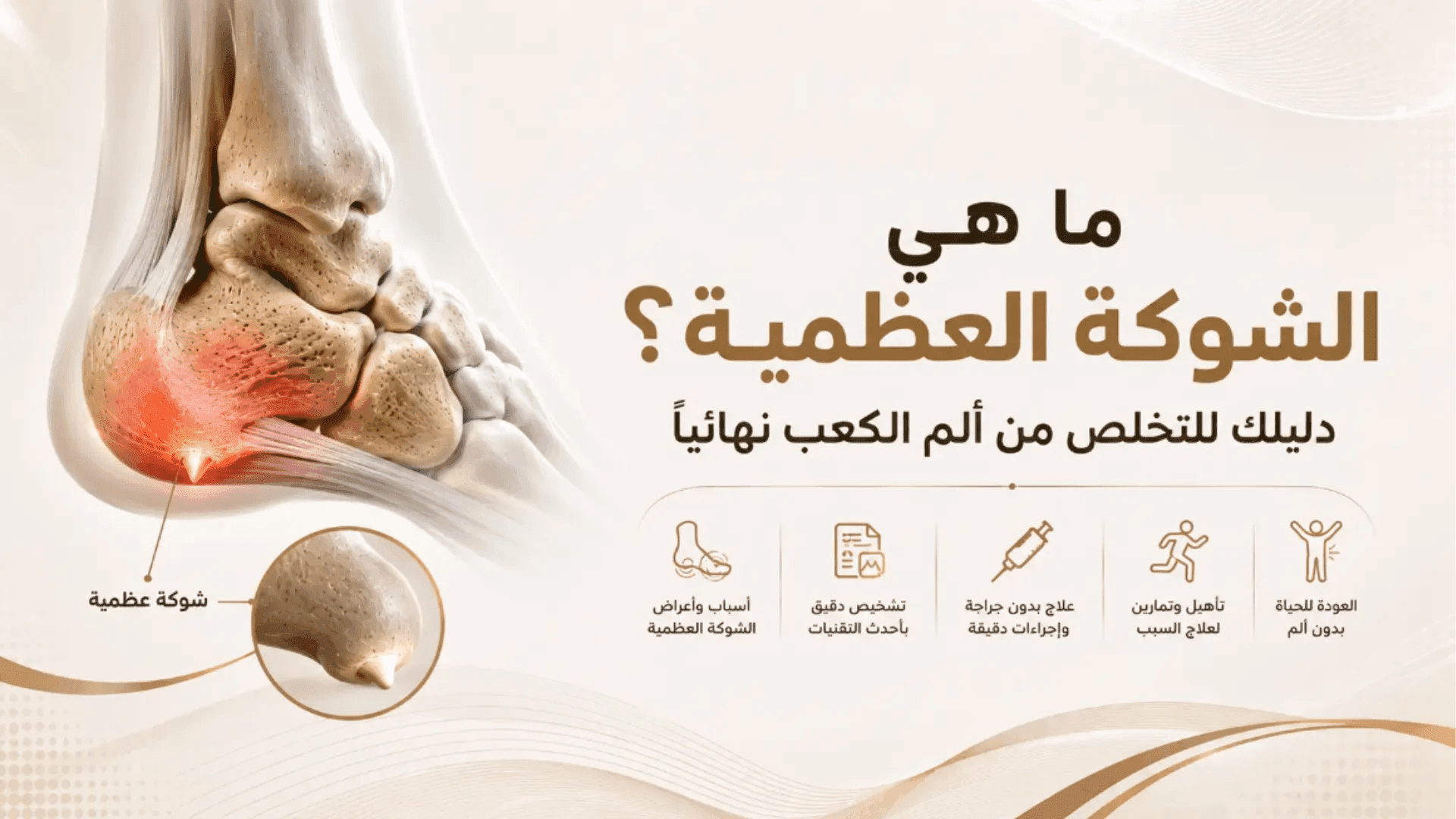 دليل توضيحي للشوكة العظمية في الكعب مع توضيح أسبابها وأعراضها وطرق التشخيص والعلاج لتخفيف ألم الكعب.