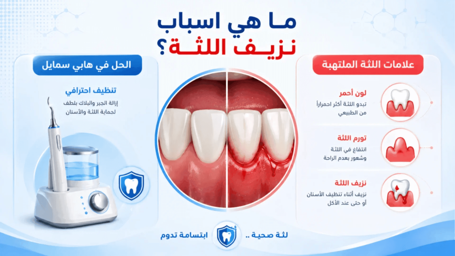 تعرف علي طريقة علاج نزيف اللثة مع عيادة هابي سمايل