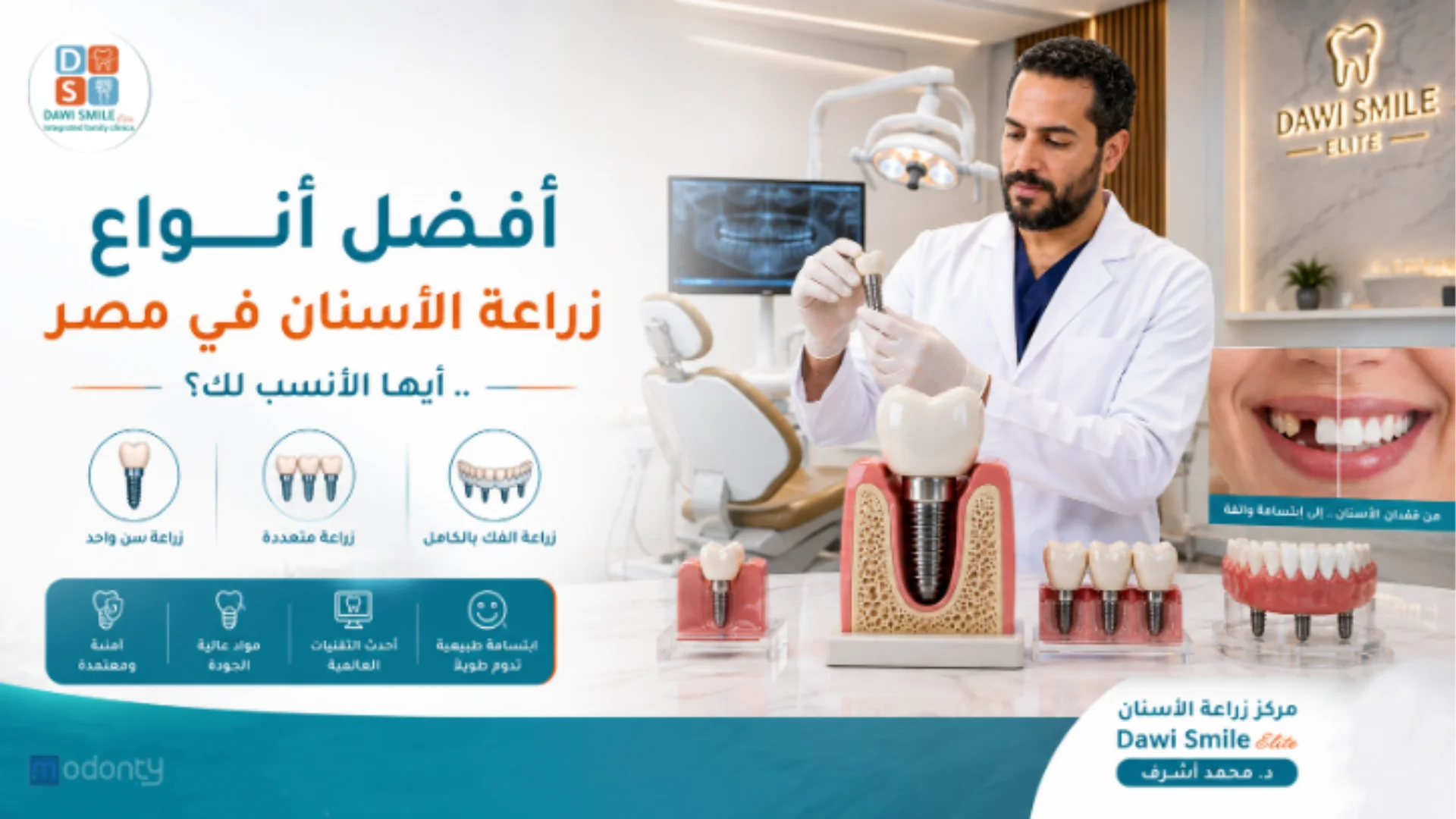 افضل أنواع زراعة الأسنان في مصر واسعارها