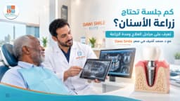كم جلسة تحتاج زراعة الأسنان؟ اعرف مراحل زراعة الأسنان ومدة العلاج مع داوي كلينك