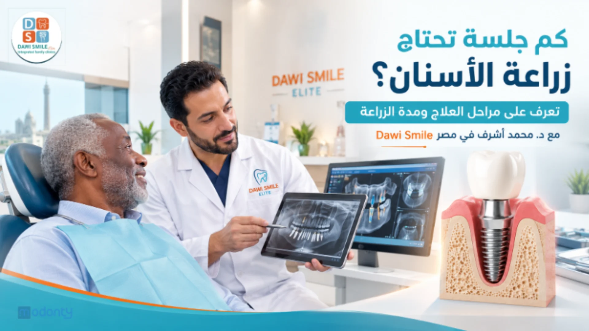 كم جلسة تحتاج زراعة الأسنان؟