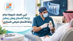 ماهي شروط نجاح زراعة الاسنان؟ وهل يمكن زراعة الأسنان لمرضى السكري؟