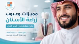 مميزات وعيوب زراعة الأسنان وأهم مراحل العلاج | د. محمد أشرف Dawi Smile في مصر