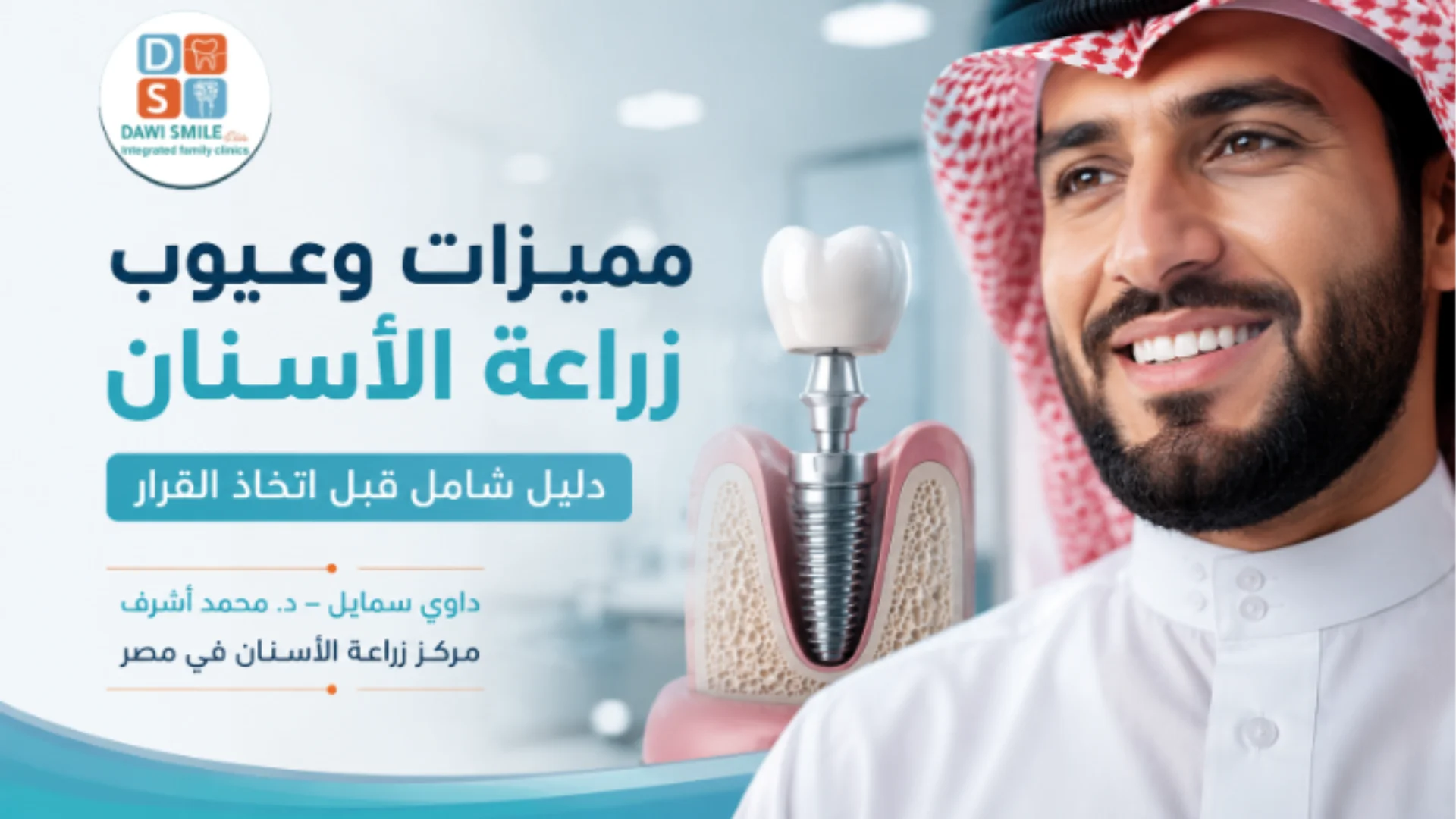 مميزات وعيوب زراعة الأسنان وأهم مراحل العلاج | د. محمد أشرف Dawi Smile في مصر