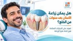 هل يمكن زراعة الأسنان بعد سنوات من الخلع ? | دليل شامل مع داوي كلينك