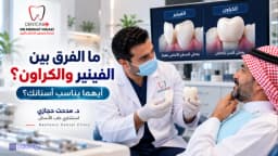 ما الفرق بين الفينير والكراون؟ وكيف تختار الأنسب لأسنانك؟ د. مدحت حجازي يوضح