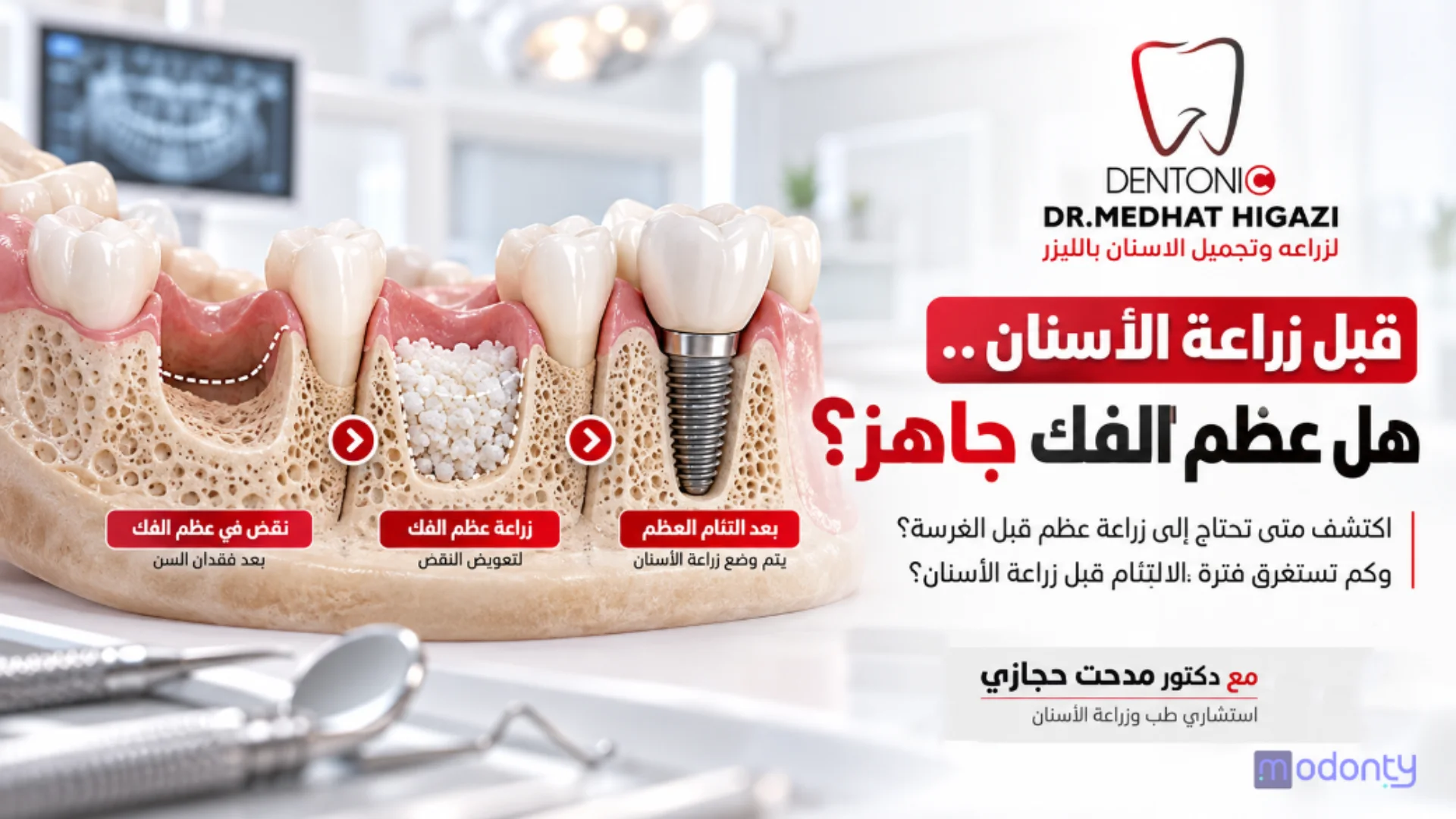 من يحتاج زراعة عظم قبل زراعة الاسنان ؟ الحالات والمدة وما يجب معرفته