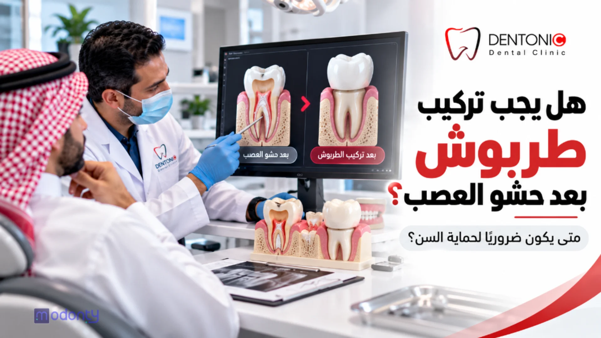 هل يجب تركيب طربوش بعد حشو العصب؟ اعرف هل يحتاج سنك إلى حماية إضافية