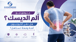 علاج الديسك: هل حقن جذور الأعصاب آمنة وفعالة؟