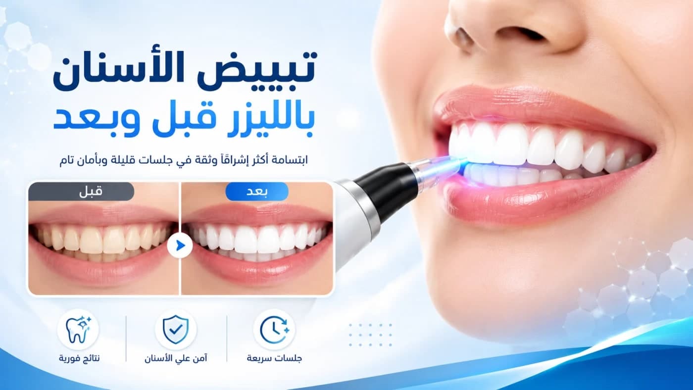 **Alt Text:**
تبييض الأسنان بالليزر مع عرض نتيجة قبل وبعد لإبراز الفرق في لون الأسنان وتحسين الابتسامة.